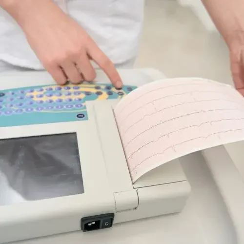 Cardiograph Cardiograph